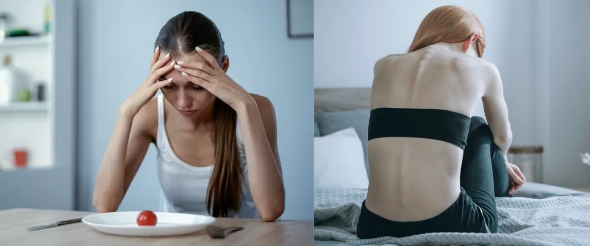 O termo caquexia pode soar estranho, mas sua origem vem do grego antigo: 